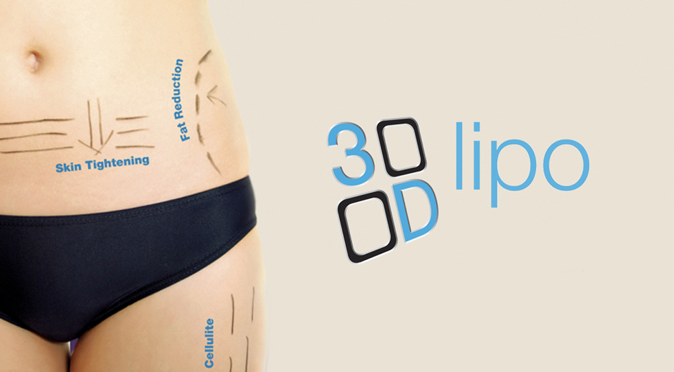 3D Lipo